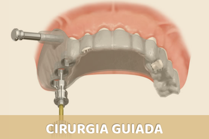 CIRURGIA GUIADA 1 Todos os serviços