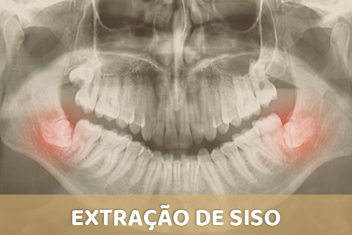 EXTRACAO SISO 1 Todos os serviços